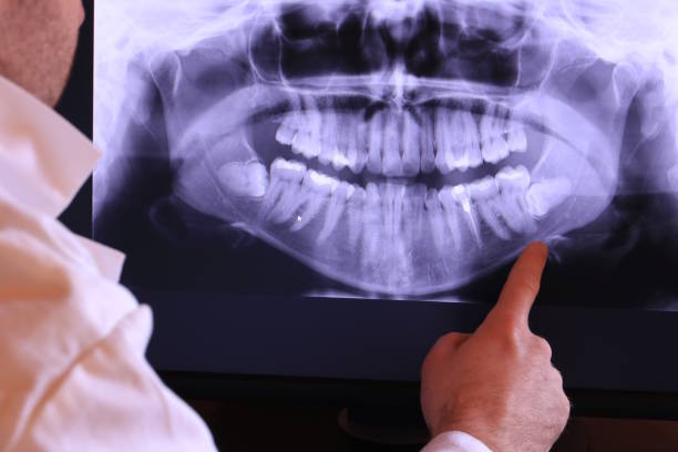 Best Broken or Chipped Tooth Repair in Lyncourt, NY